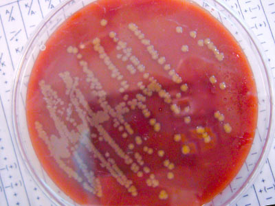 petri dish with growth